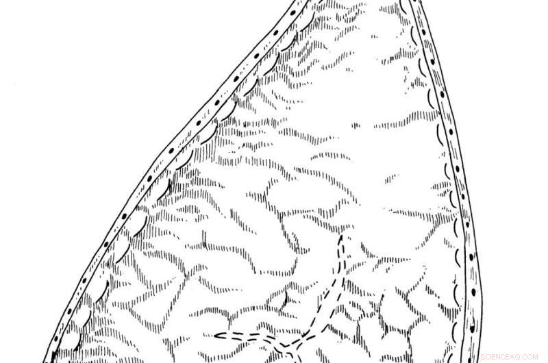 Pointed‑Toe Shoes and the Rise of Bunions in Medieval Britain: New Findings