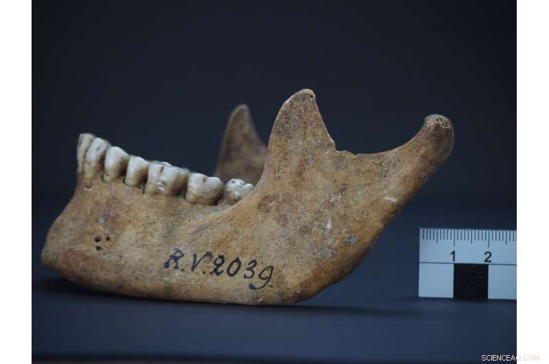 5,000-Year-Old Hunter Found to Carry Earliest Known Plague Bacteria