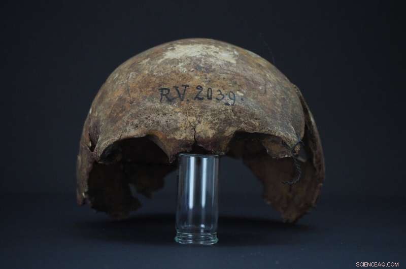 5,000-Year-Old Hunter Found to Carry Earliest Known Plague Bacteria