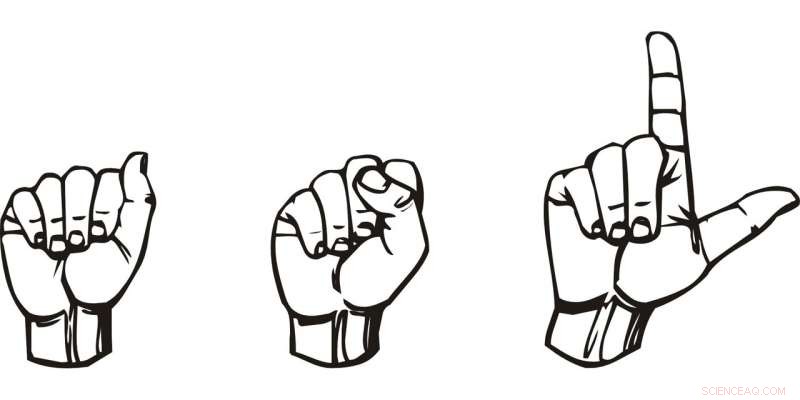 Boosting Diversity in UK Sign Language Translation & Interpretation: A Call for Inclusive Representation