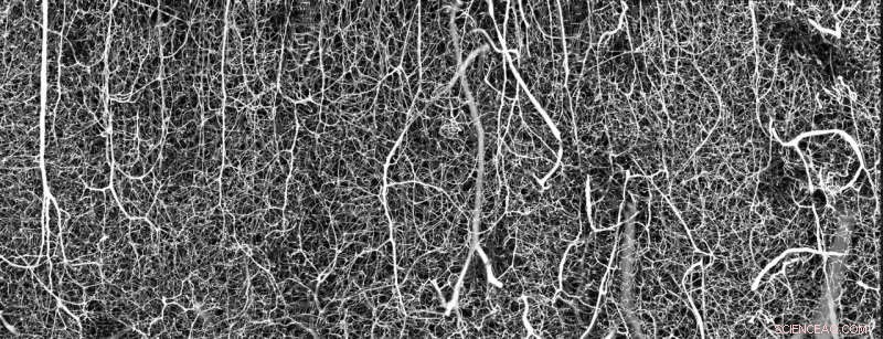 Ohio State Scientists Capture Award-Winning Micrographs of Mouse Brain Vasculature