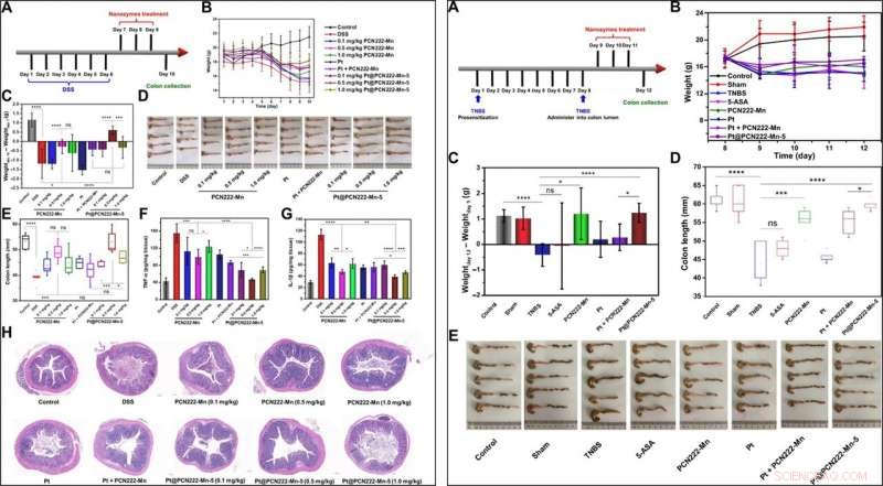 Engineered Nanozymes Target Reactive Oxygen Species for Enhanced Anti-Inflammatory Therapy