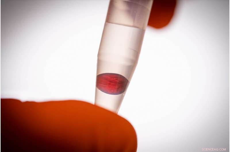 Scientists Turn Nanocellulose into Gold‑Like, Antibacterial, Thermo‑Responsive Materials