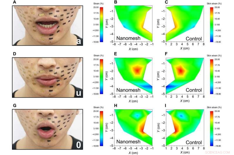 Durable On‑Skin Nanomesh Sensor for Real‑Time Skin Motion Monitoring