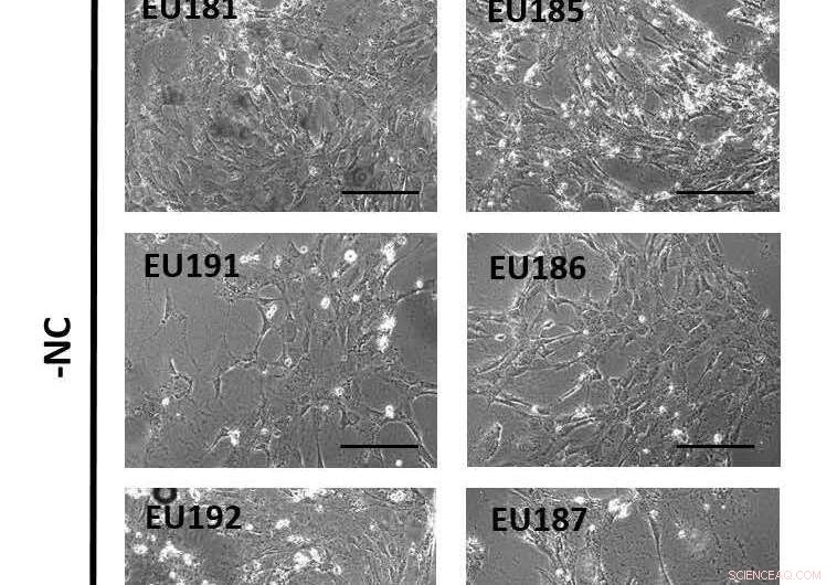 Nanoparticle Antioxidants: Safeguarding Tissue Health