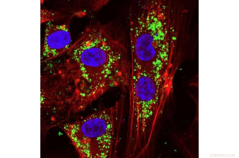 Nanoparticle Antioxidants: Safeguarding Tissue Health