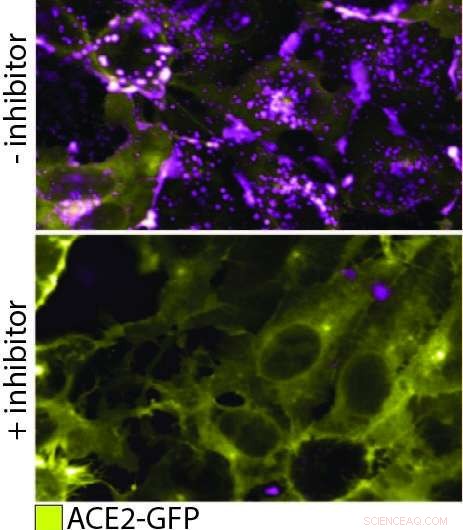 Real-time Imaging Reveals How SARS‑CoV‑2 Invades Human Cells