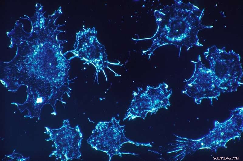 Revolutionary Nanotech Enhances Photodynamic Cancer Therapy