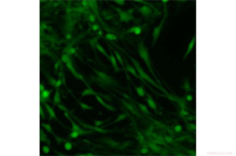 New Cell Perturbation System Offers Promising Medical Applications