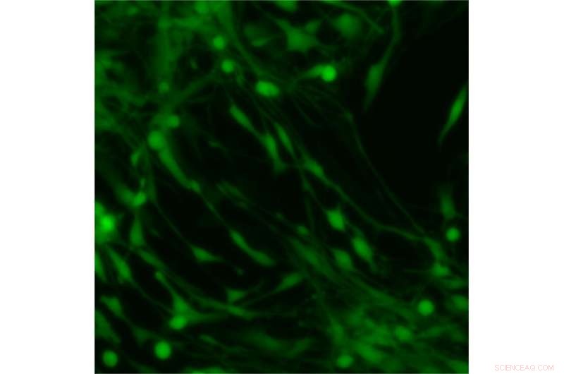 New Cell Perturbation System Offers Promising Medical Applications