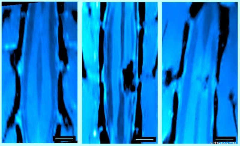 Carbon Nanotube Sponge Implants Restore Neural Connections in Spinal Cord Injury