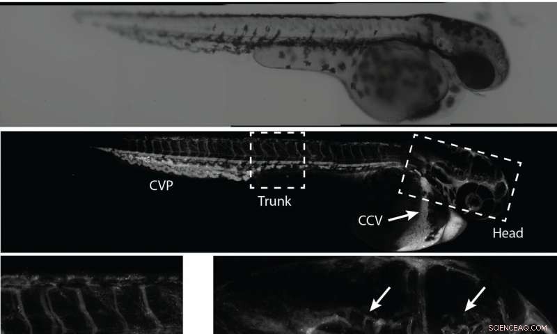 Nanoparticle-Delivered Drugs Cross the Blood‑Brain Barrier to Combat Neurodegenerative Diseases
