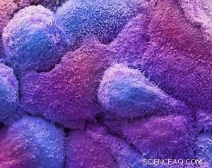 Gold-Catalyzed Prodrug Activation Eliminates Breast Cancer Cells