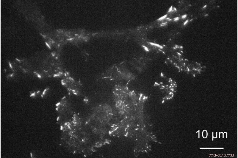 Achieving Higher-Resolution Live-Cell Imaging with Plasmonic Metasurfaces