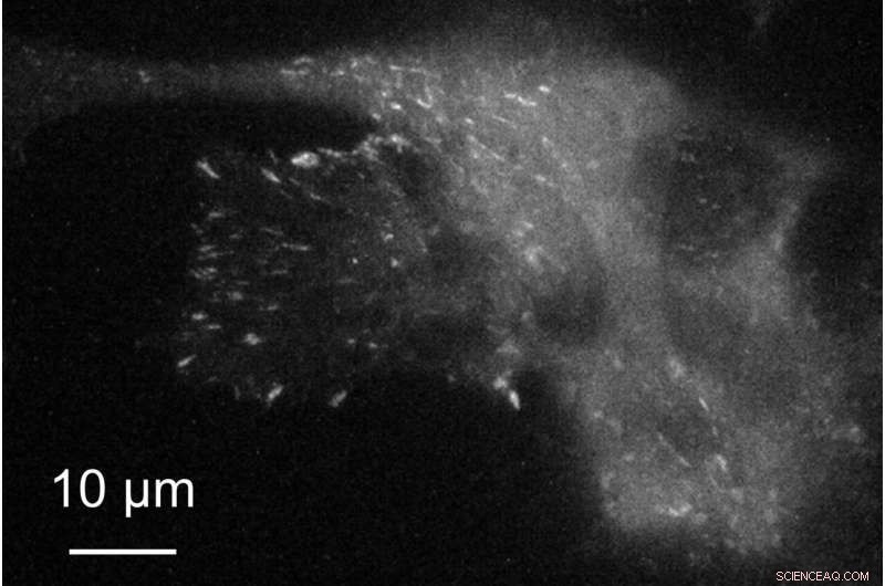 Achieving Higher-Resolution Live-Cell Imaging with Plasmonic Metasurfaces