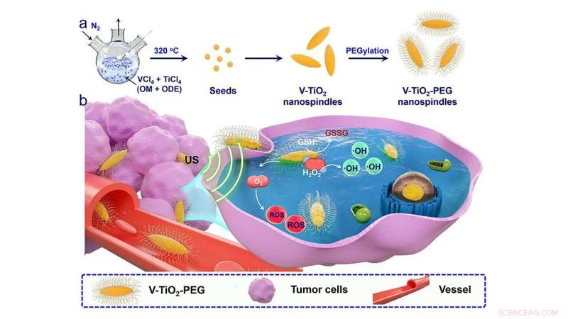 Vanadium‑Doped Nanospindles Boost Ultrasound‑Assisted Cancer Therapy