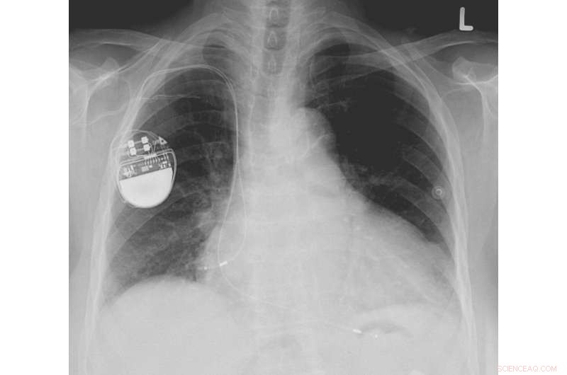 Nano-Thin Piezoelectric Materials Enable Self-Powered Electronics