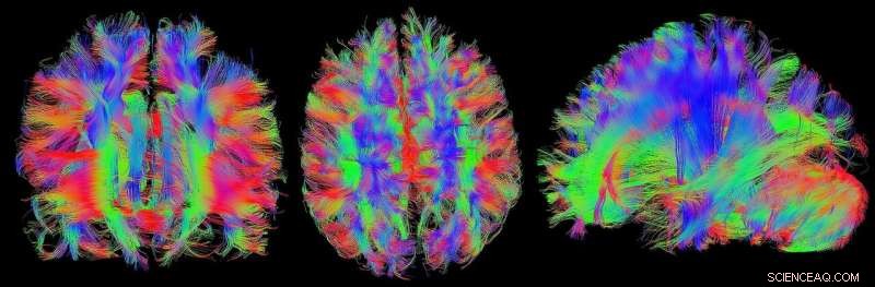 Zirconium‑89 Labeled Microcapsules Enable Long‑Term PET Tracking of Drug Delivery
