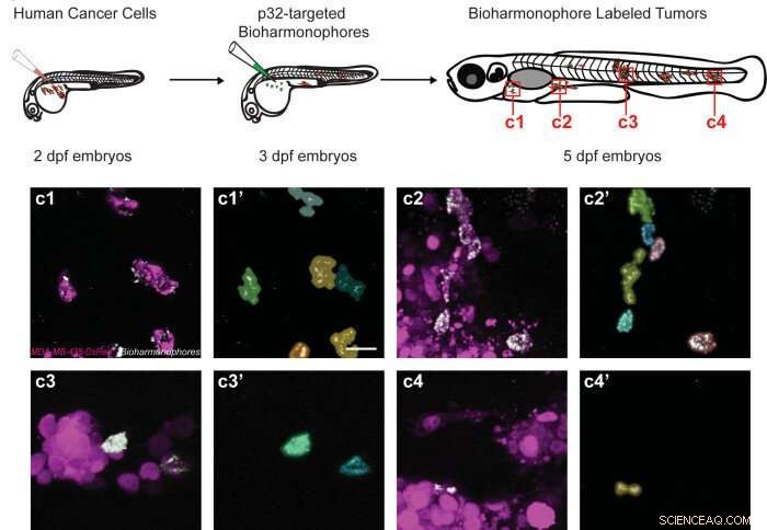 Bright, Precise Tumor Imaging with Breakthrough Biodegradable Nanoprobes