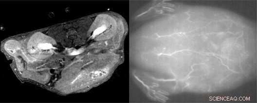 Precise Nanoparticle Size Optimization Enables High-Resolution MRI and Near-Infrared Imaging During Surgery