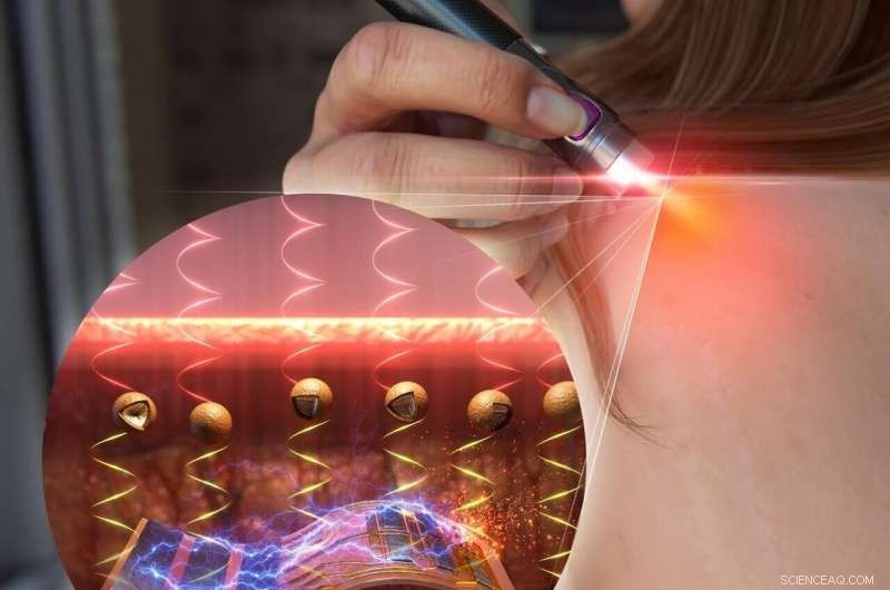 New NIR Light-Triggered System Enables On-Demand In Vivo Drug Delivery