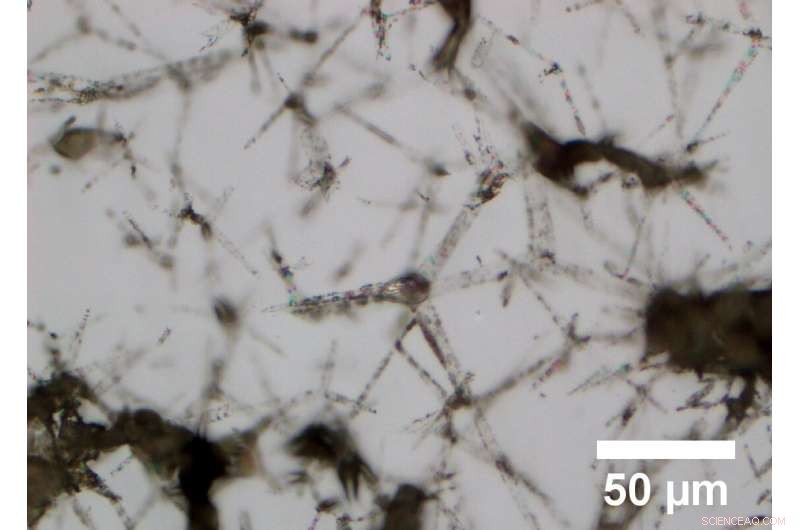 Scientists Develop Highly Conductive Hydrogel for Controlled Drug Delivery in Brain Therapies