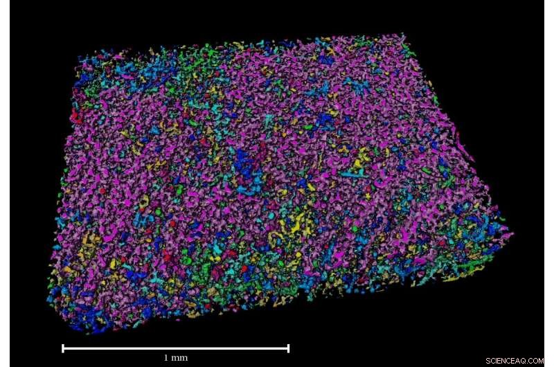 Scientists Develop Highly Conductive Hydrogel for Controlled Drug Delivery in Brain Therapies