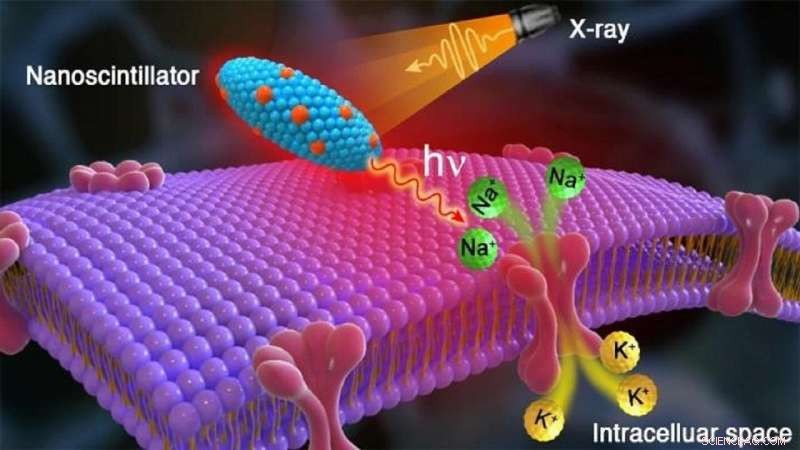 Innovative X‑Ray Technique Promises Wireless Brain Stimulation for Movement Disorder Patients