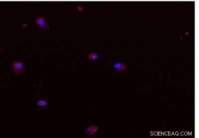 Nanotech Breakthrough: Detecting Bone‑Repair Stem Cells for Fracture Treatment