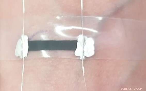 Trinity College Dublin Innovates Graphite‑Based Sensors for Next‑Gen Wearable Medical Devices