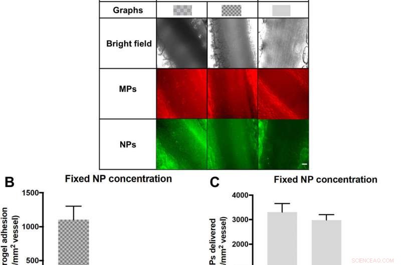 Flexible Microparticles as Targeted Drug Carriers for Nanoparticle Delivery to the Vascular Wall