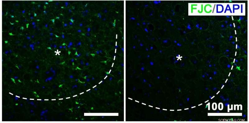Nano-Photosynthetic Therapy: A Promising New Approach to Stroke Treatment