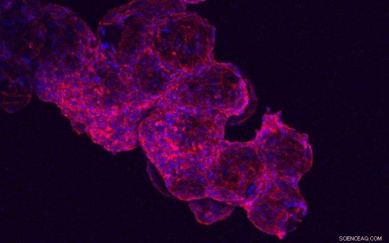 Injectable Microspheres Offer Hope for Heart Failure Repair