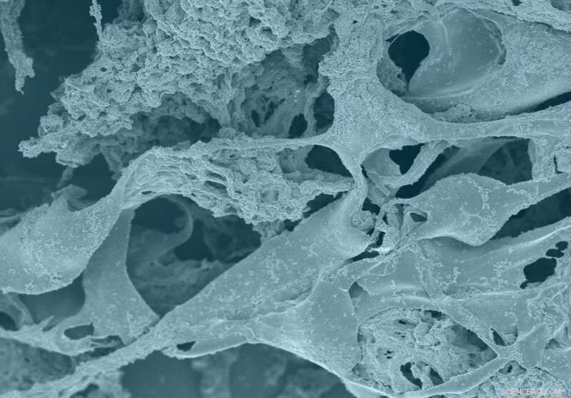 Flexible, Metal‑Free Hydrogel Electrodes Protect Organs During Medical Procedures