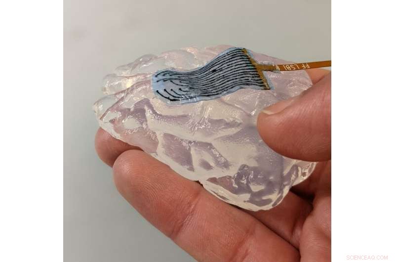 Flexible, Metal‑Free Hydrogel Electrodes Protect Organs During Medical Procedures