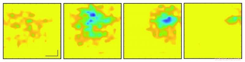 Graphene-Based Camera Captures Real-Time Electrical Activity of a Beating Heart