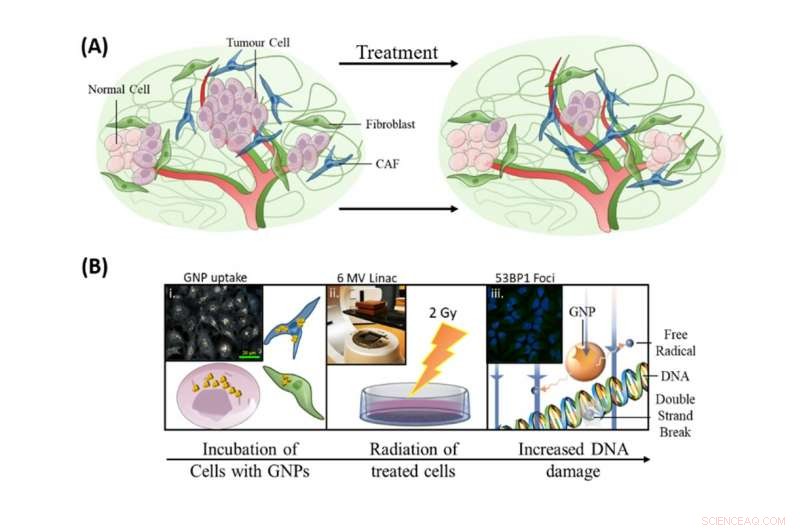 Gold Nanoparticles Enhance Tumor Radiation Therapy, Minimizing Damage to Healthy Tissue