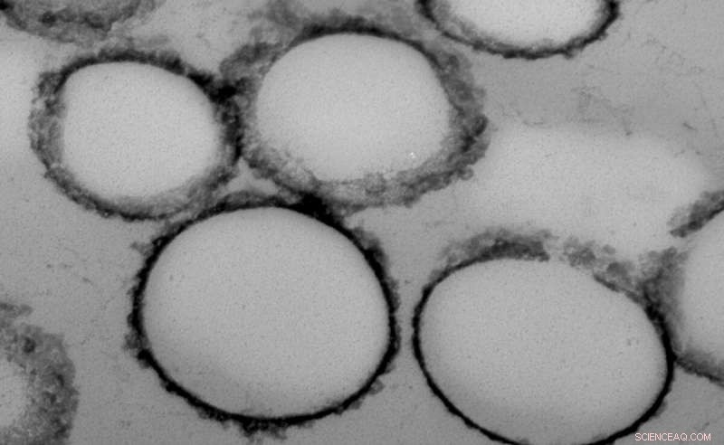 Griffith University Breakthrough: Magnetized Nanobeads for Early Cancer Detection