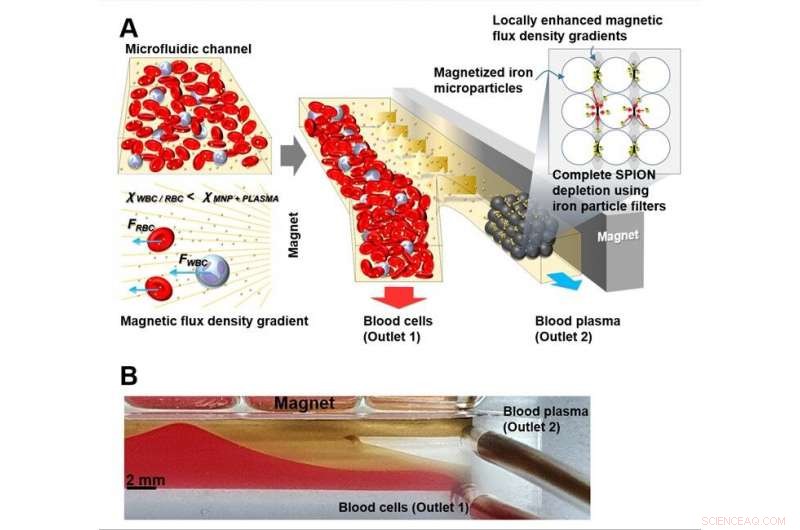 Revolutionary Magnet‑Based Plasma Separation Technique Achieves Hemolysis‑Free, High‑Efficiency Results