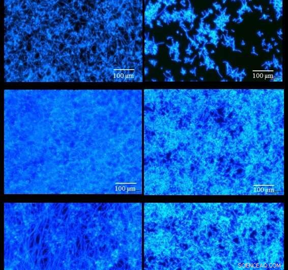 Revolutionary Nanotech Tackles Drug-Resistant Fungal Infections