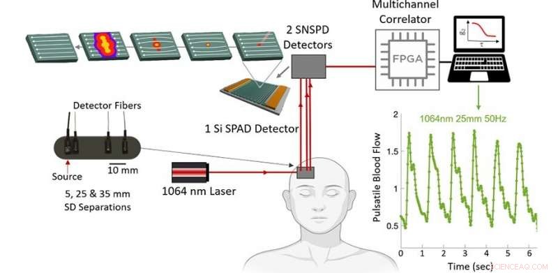Superconducting Nanowire Single‑Photon Detectors: The Next Frontier in Blood Flow Measurement