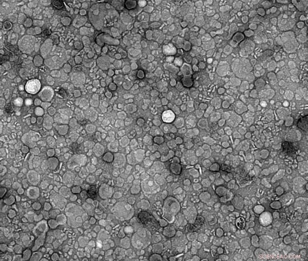 Scientists Convert Cow s Milk into Nano-Scale Drug Delivery Capsules