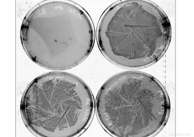 University of Queensland Unveils Nanoworm Coating to Neutralize COVID-19