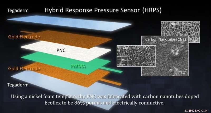 New Soft Pressure Sensor Breakthrough Eliminates Key Bottleneck in Medical Wearables