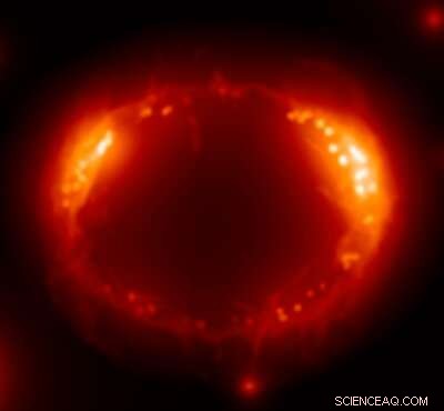 Measuring Atomic Temperatures in the Shock Wave of SN1987A