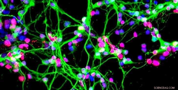 Dopaminergic Neuron Study Aims to Reveal Causes of Parkinson’s Disease