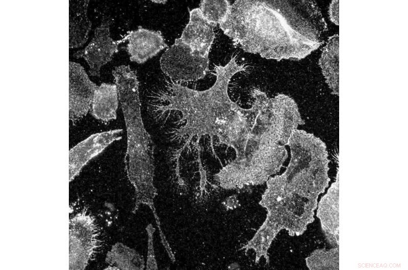 Dopaminergic Neuron Study Aims to Reveal Causes of Parkinson’s Disease