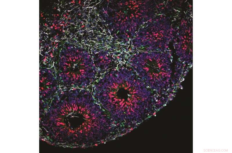 Developing Advanced Brain Organoid Models for Space-Based Neurological Research
