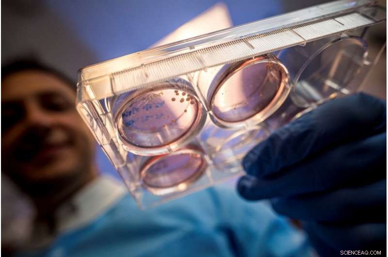 Developing Advanced Brain Organoid Models for Space-Based Neurological Research