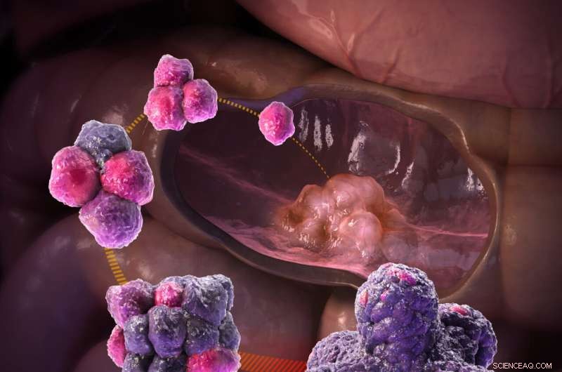 NTNU s Tumors in Space Project Investigates Cosmic Radiation s Cancer Risk